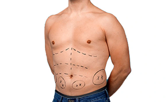 Food Service & Patient Care