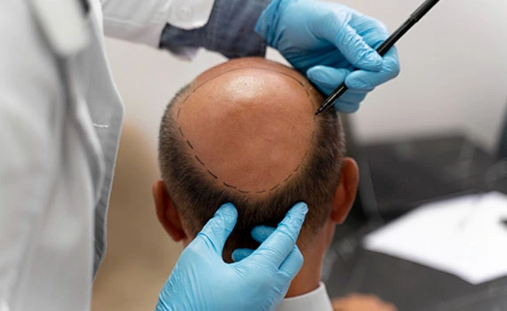 Food Service & Patient Care