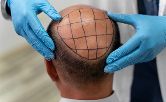 Pre-Flight Booking Assistance