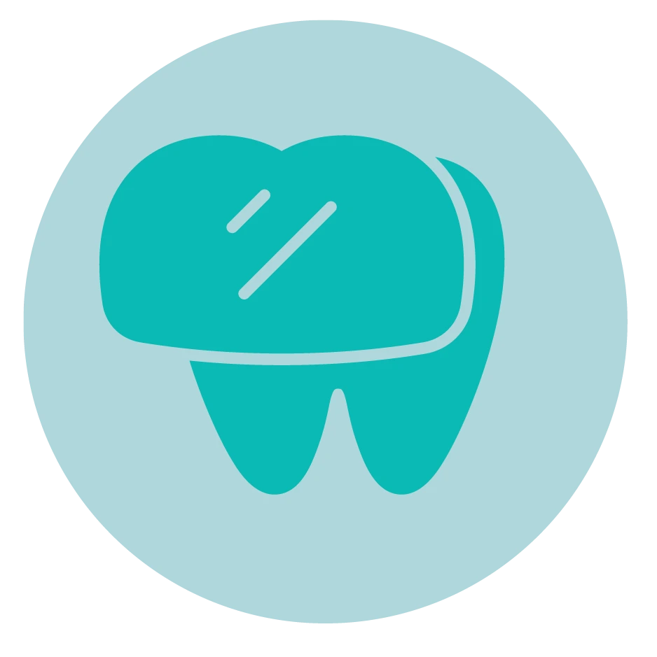Dental-Veneers