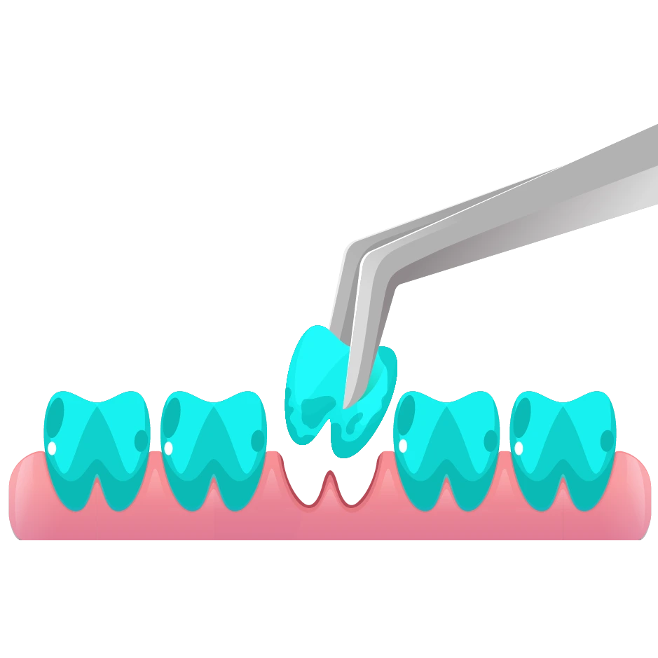 Dental-Extraction