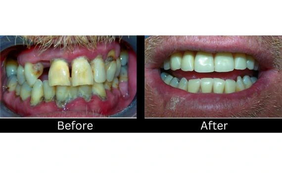 Patient Result
