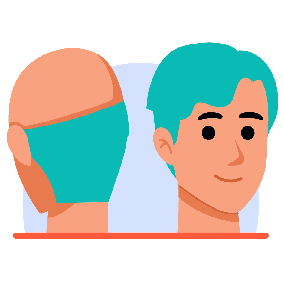 Direct-Hair-Implantation