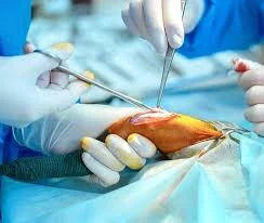 Orthopedic Surgery in Malaysia